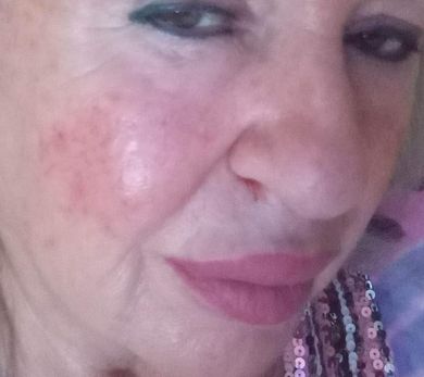 lezeres-pattanasos-bor-kezeles-gyors-hatas-04