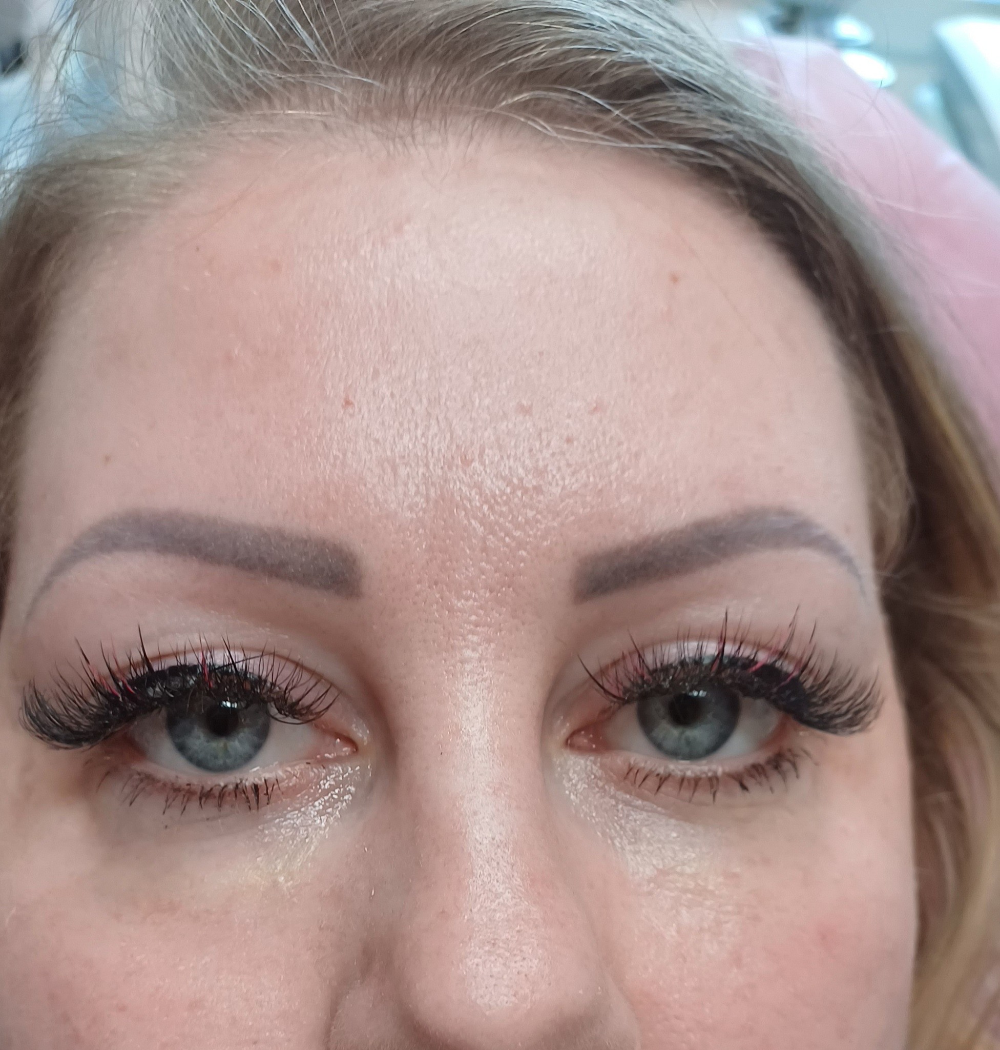 szem alatti töltés-kész