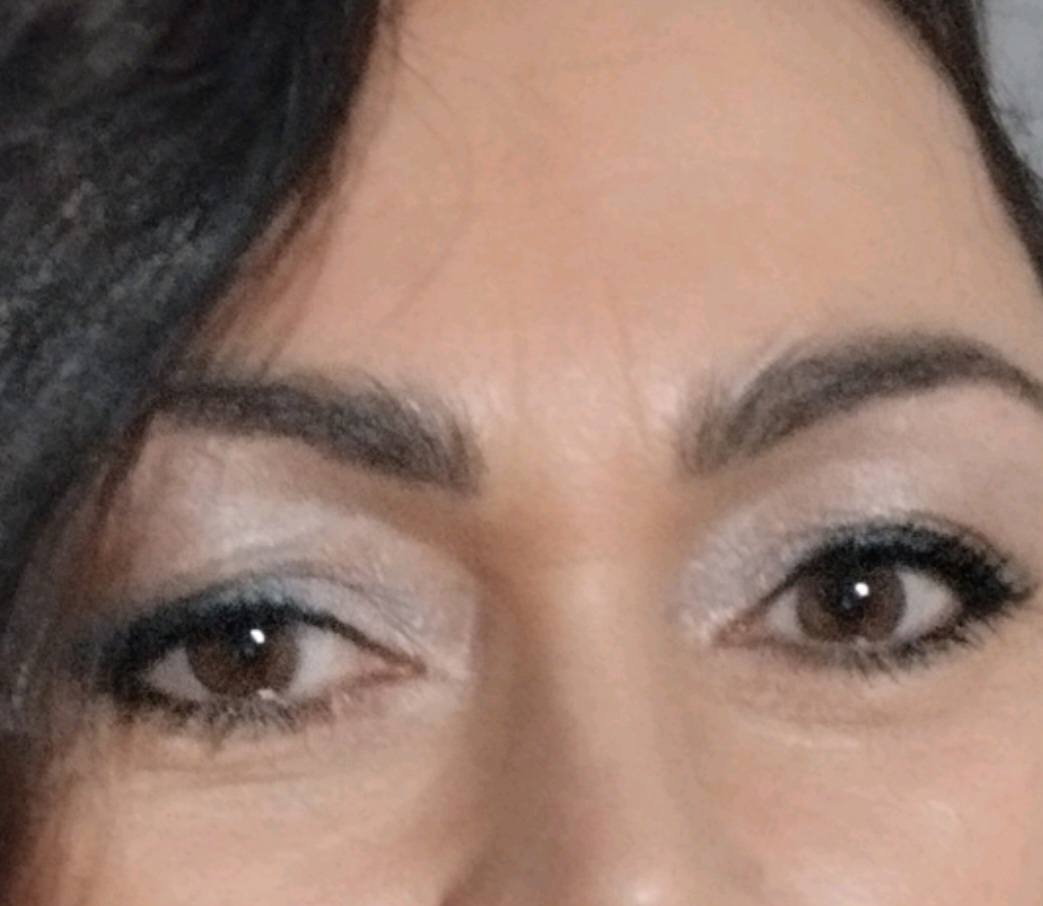 szemkönyéki2-kész