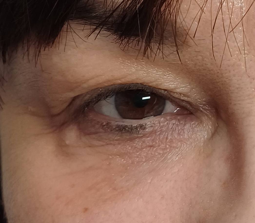 szemkönyéki3-kész